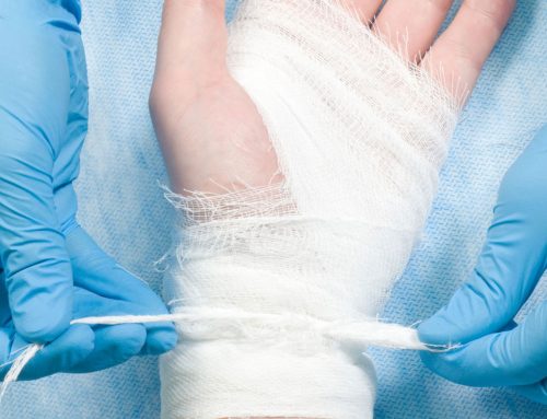 Broken Bone Work Injuries and Compensation