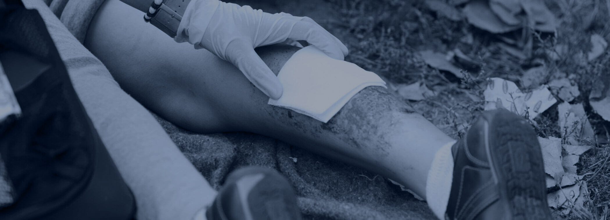 Minnesota burn injury lawyer